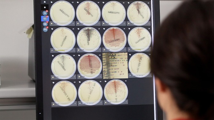 Speed Up Clinical Diagnoses With Next Generation Software...